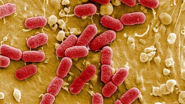 La bactérie a déjà infecté plus de 2200 personnes en Europe. [Manfred Rohde - Centre Helmholtz pour les infections]