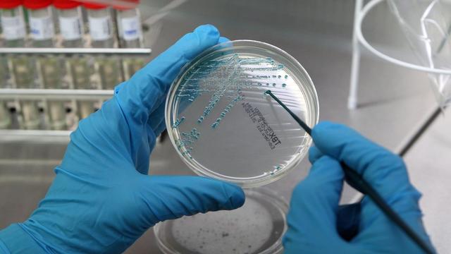 Les analyses ont montré qu'une deuxième personne a été contaminée en Suisse. [EPA/BERND WUESTNECK]