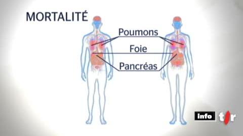 Journée mondiale contre le cancer: la maladie touche 35'000 Suisses chaque année