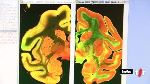 Lausanne: une équipe du CHUV est parvenu à réimplanter des cellules nerveuses à un singe