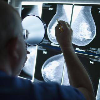 Le cancer du sein a tué près de 1400 femmes en 2010, derrière le cancer des poumons (3100). [Gaetan Bally]