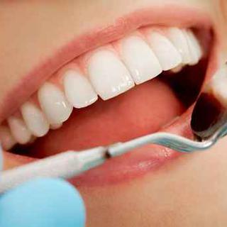 Le blanchiment dentaire provoque l'engouement auprès de nombreux Romands. [Fotolia - Pressmater]