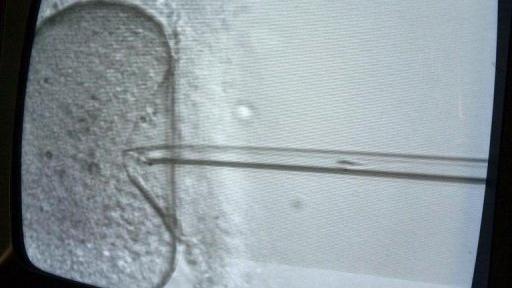 Photo prise sur un écran, d'un spermatozoïde s'apprêtant à pénétrer l'intérieur d'un ovocyte