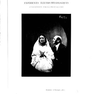 Expériences électro-physiologiques représentées par la photographie. Ouvrage de Duchenne de Boulogne (1862). [dr]