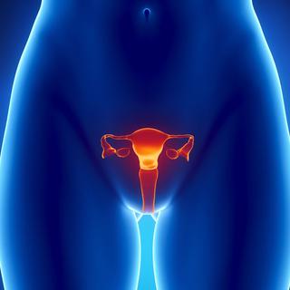 Le syndrome des ovaires polykystiques ne peut se soigner en tant que tel. On peut néanmoins en soulager les symptômes. système reproducteur féminin, femme [CLIPAREA.com]