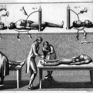 Expérience de galvanisme opérée sur un cadavre en 1803. [gallica.fr]