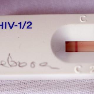 Test du sida, près du Cap en Afrique du Sud, en 2010
