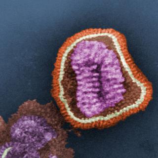 Le virus H1N1, dit de la "grippe porcine".