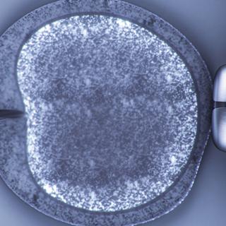 Un ovule lors d'une opération de fécondation in vitro. [digitalbalance]