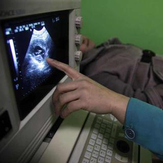Le remboursement de l'avortement par l'assurance maladie de base est remis en question par une initiative soumise au peuple le 9 février 2014. [AP/Ng Han Guan]