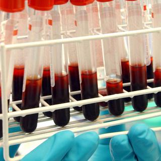 Des échantillons de sang destinés à des analyses anti-dopage. [Florence Durand]