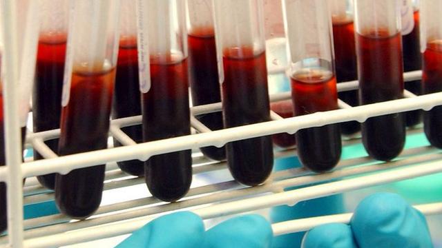 Des échantillons de sang destinés à des analyses anti-dopage. [Florence Durand]