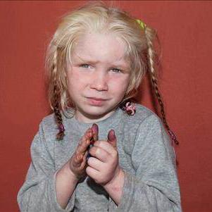 La fillette découverte dans un camp rom en Grèce a été surnommée l'"ange blond" par la presse. [Police grecque]