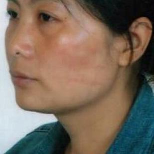 Li Yan avait tué son mari qui la violentait. [Amnesty - Private]