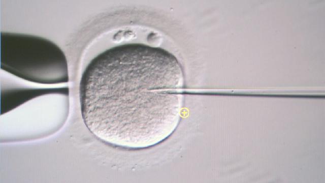 Un ovule est fécondé artificiellement