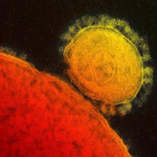 Image de la transmission du coronavirus MERS. [AP Photo/National Institute for Allergy and Infectious Diseases via The Canadian Press]