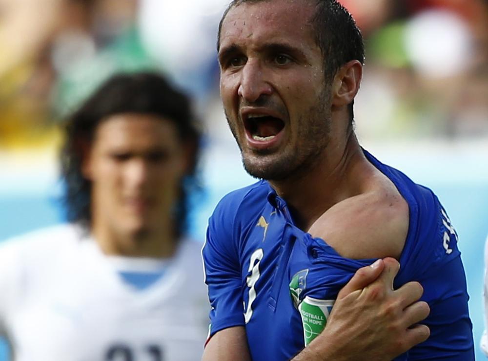 Giorgio Chiellini exhibe son épaule "meurtrie" par Suarez. [REUTERS - Tony Gentile]