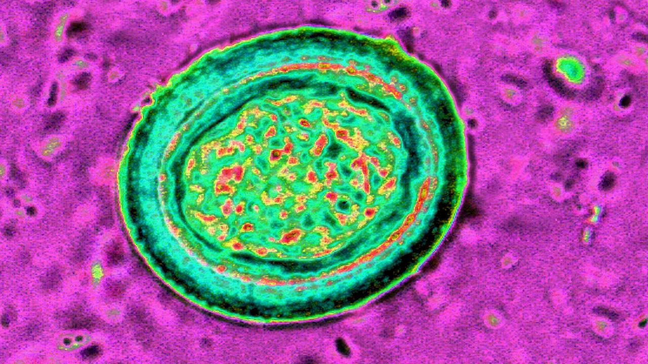 Un œuf de ténia au microscope.
Cavallini James / bsip
AFP [Cavallini James / bsip]