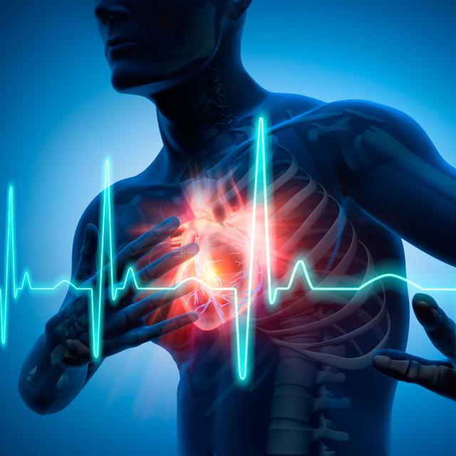 Les maladies cardiovasculaires sont la première causes de mortalité en Suisse. [psdesign1]