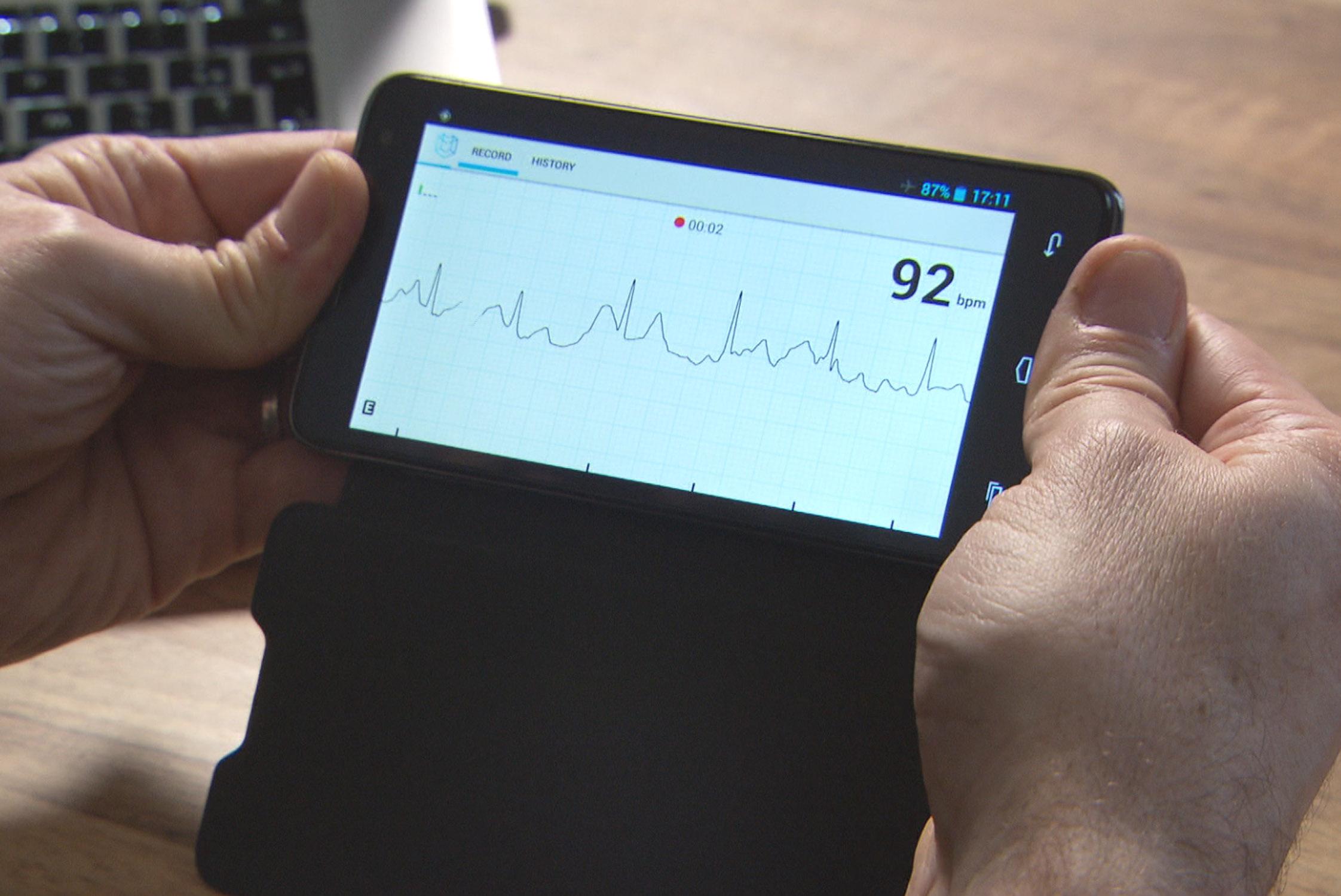 Équipé d'une coque spéciale, votre smartphone peut se transformer en électrocardiogramme.