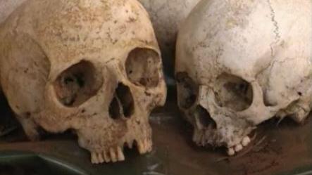Crânes de victimes du génocide au Rwanda. [RTS]