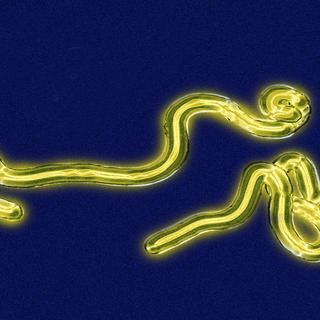 Le virus Ebola. [Cavallini James / BSIP]