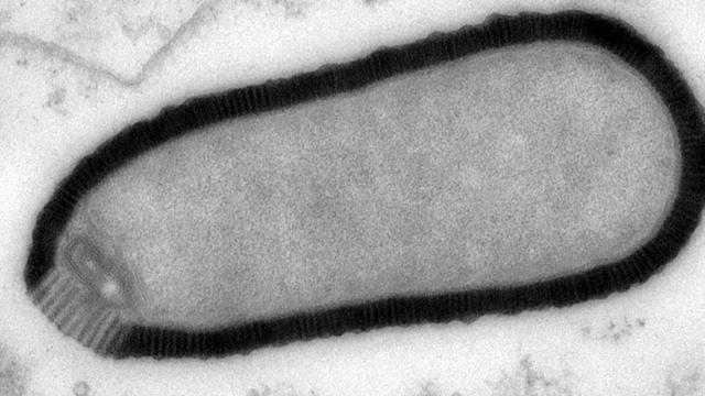 Même vieux de 30'000 ans, le virus géant nouvellement identifié est toujours capable d’infecter son hôte. [AP/Keystone - Julia Bartoli, Chantal Abergel]