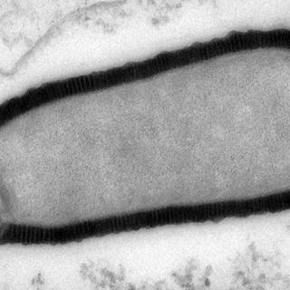 Même vieux de 30'000 ans, le virus géant nouvellement identifié est toujours capable d’infecter son hôte. [AP/Keystone - Julia Bartoli, Chantal Abergel]