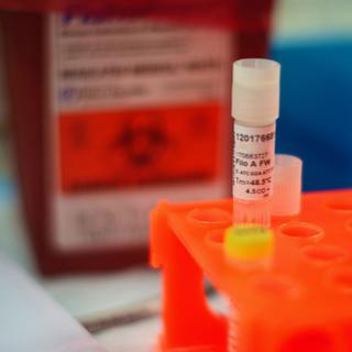 Le vaccin pour des tests contre Ebola sont arrivés à Genève. [AP Photo/Stephen Gire, Science]