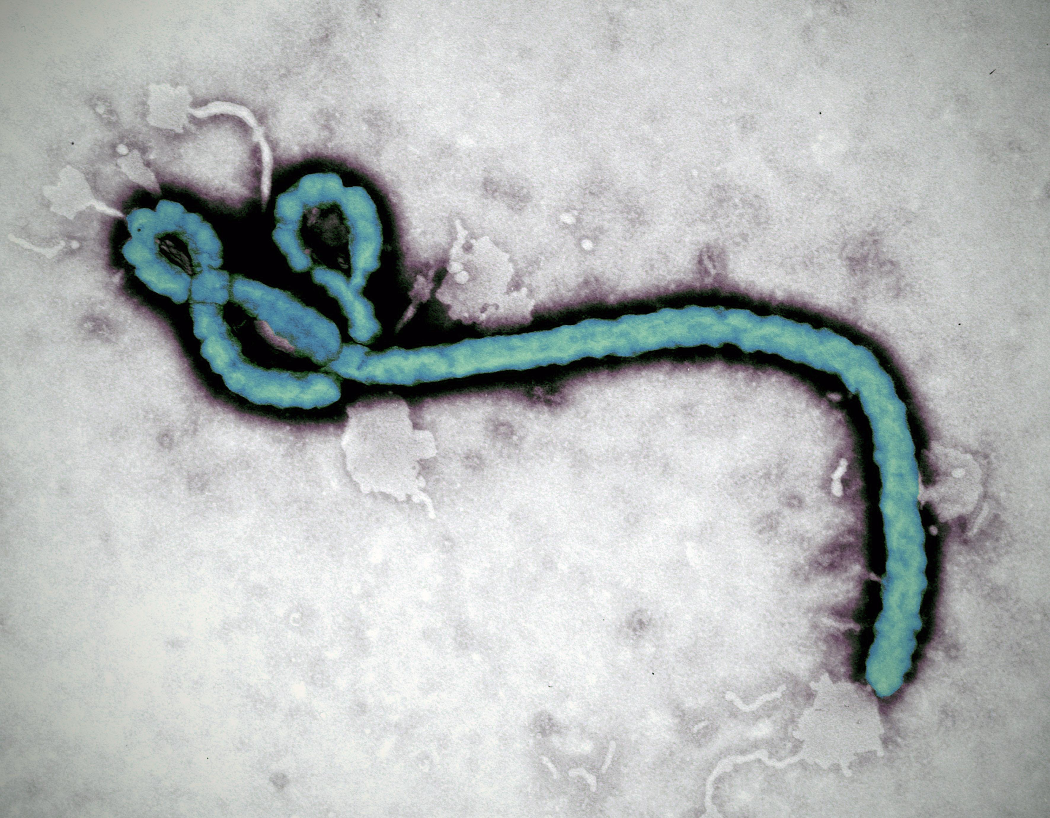 Le virus Ebola. [RTS]