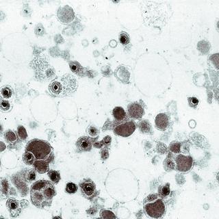 Cytomegalovirus au microscope électronique. [Callista Images / Cultura Creative / AFP]