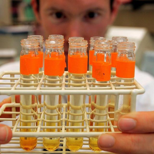 Des tests d'urine. [Keystone - Fabrice Coffrini]