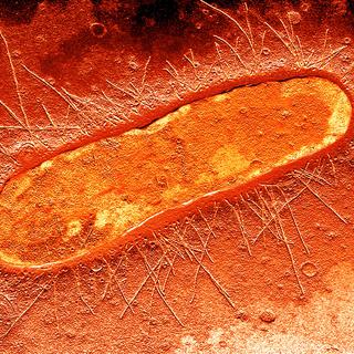 Bactérie d'Escherichia Coli, cause de nombreuses infections intestinales. [Sercomi/BSIP]