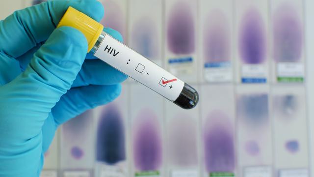 La Commission européenne autorise un nouveau traitement contre le virus du sida. [Fotolia - jarun011]