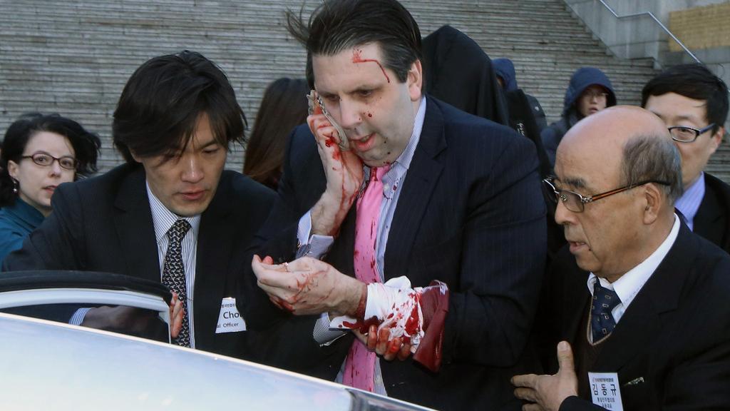 L'ambassadeur des Etats-Unis à Séoul, Mark Lippert, a été blessé jeudi 5 mars par un homme armé. [KIM JU-SUNG]