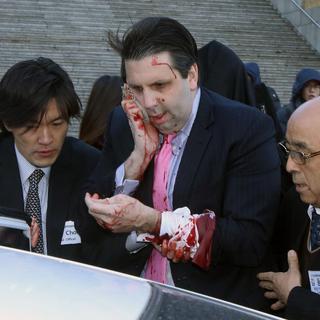 L'ambassadeur des Etats-Unis à Séoul, Mark Lippert, a été blessé jeudi 5 mars par un homme armé. [KIM JU-SUNG]