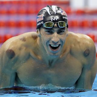 Le nageur Michael Phelps et ses marques de ventouses lors des Jeux olympiques de Rio. [David J. Phillip - AP Photo]
