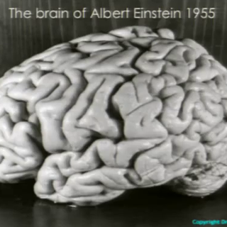 Le cerveau d'Albert Einstein. [Thomas Harvey]