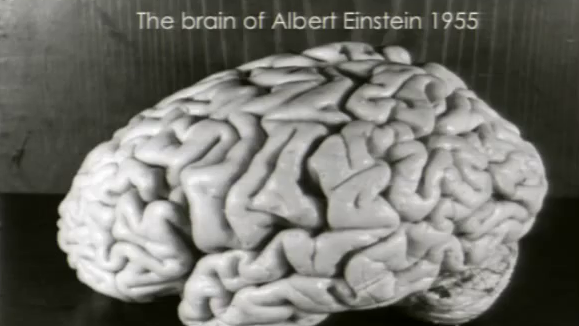 Le cerveau d'Albert Einstein. [Thomas Harvey]