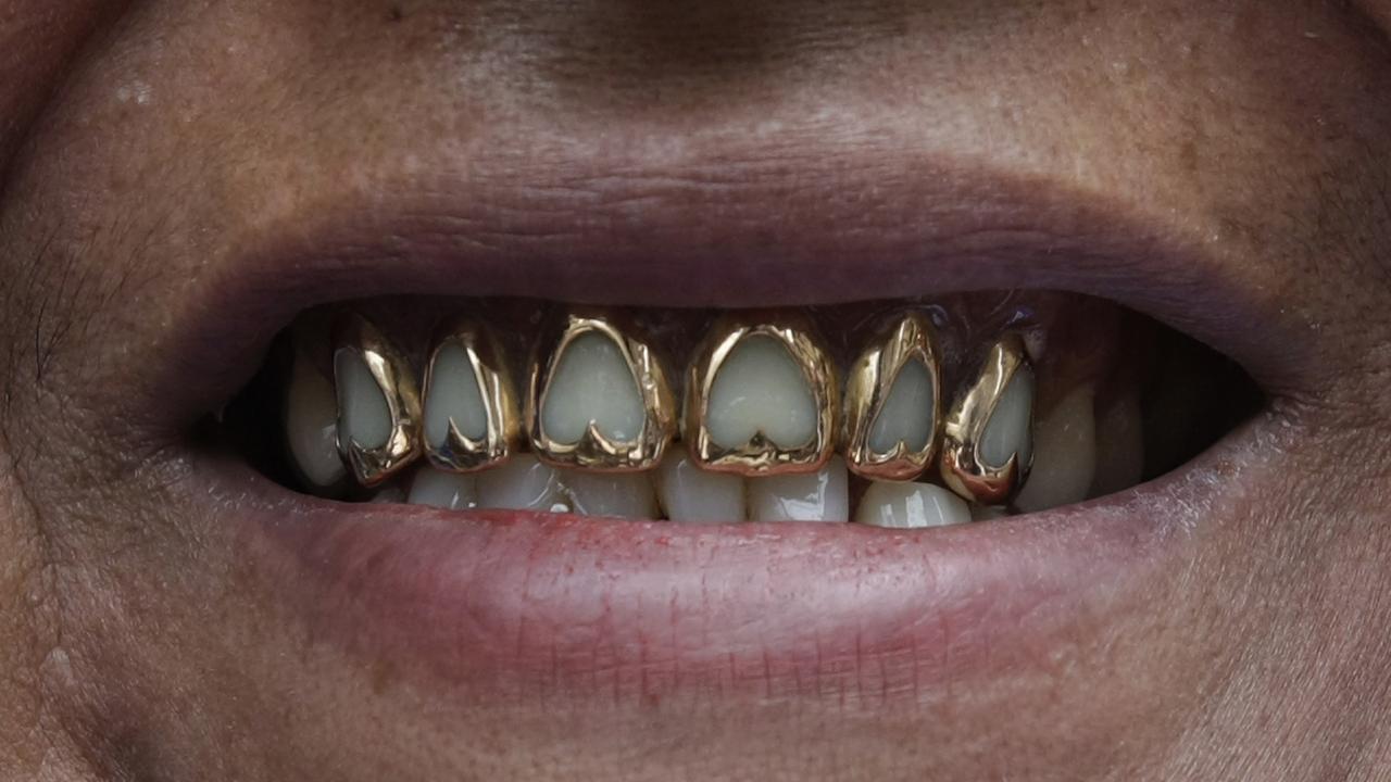 La Croix-Rouge suisse récolte chaque année une vingtaine de kilos d'or dentaire. [Reuters - David Mercado]