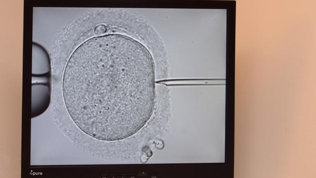 Une image d'un essai de procréation médicalement assistée avec la technique de l'ICSI. [BSIP/AFP - Humbert]