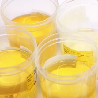 L'urine est stérile et dépourvue de microbes, mais rien ne prouve que la boire soit vraiment bon pour la santé. [AFP - MFE / Science Photo Library]