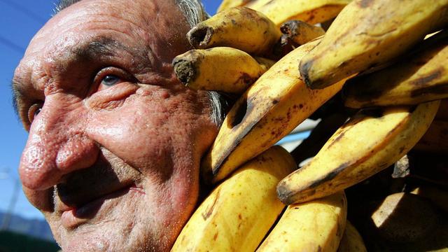 Mélanome et peau de banane [EPA/JEFFREY ARGUEDAS]