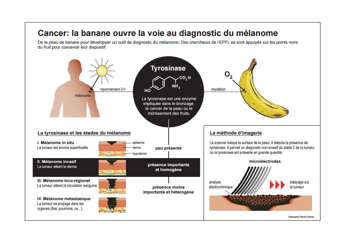 Mélanome et banane - les explications en détails de l'EPFL [© 2016 EPFL/Pascal Coderay]
