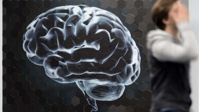 Une image géante d'un cerveau en marge de la conférence de presse sur le campus Biotech à Genève. [Laurent Gillieron]