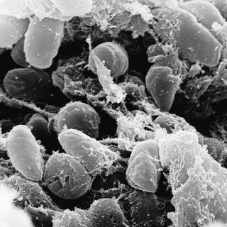 La bactérie Yersinia, à l'origine de la peste bubonique.
AP Rocky Mountain Laboratories
Keystone [AP Rocky Mountain Laboratories]
