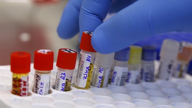 Un cas de transmission du virus Zika par voie sexuelle a été annoncé par les autorités du Texas.