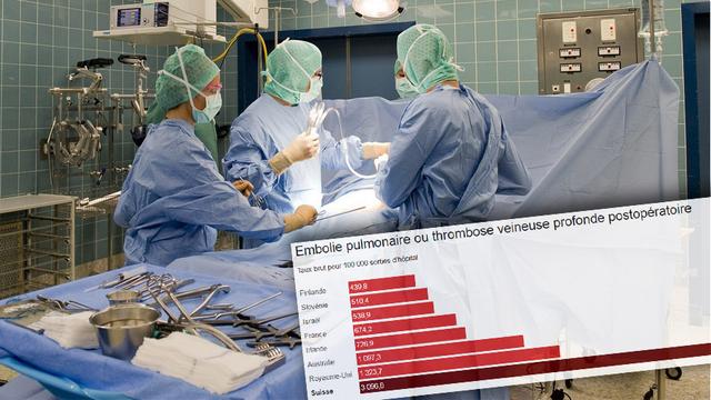 En matière d'embolie pulmonaire ou de thrombose veineuse après une opération, la Suisse arrive dernière des pays pris en compte par l'OCDE. [RTS - Keystone]