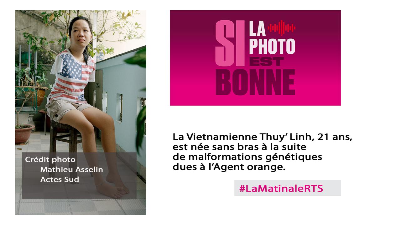 Le photographe Mathieu Asselin a mené une enquête photographique sur les victimes de l'agent orange, qui fait l'objet d'un livre paru aux éditions Acte Sud. [Mathieu Asselin]