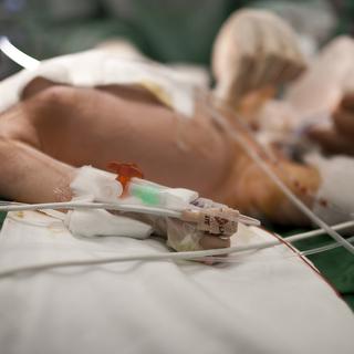 Implantée sur un nouveau-né, la prothèse synthétique doit être changée tout au long de sa croissance. [Keystone - Gaëtan Bally]